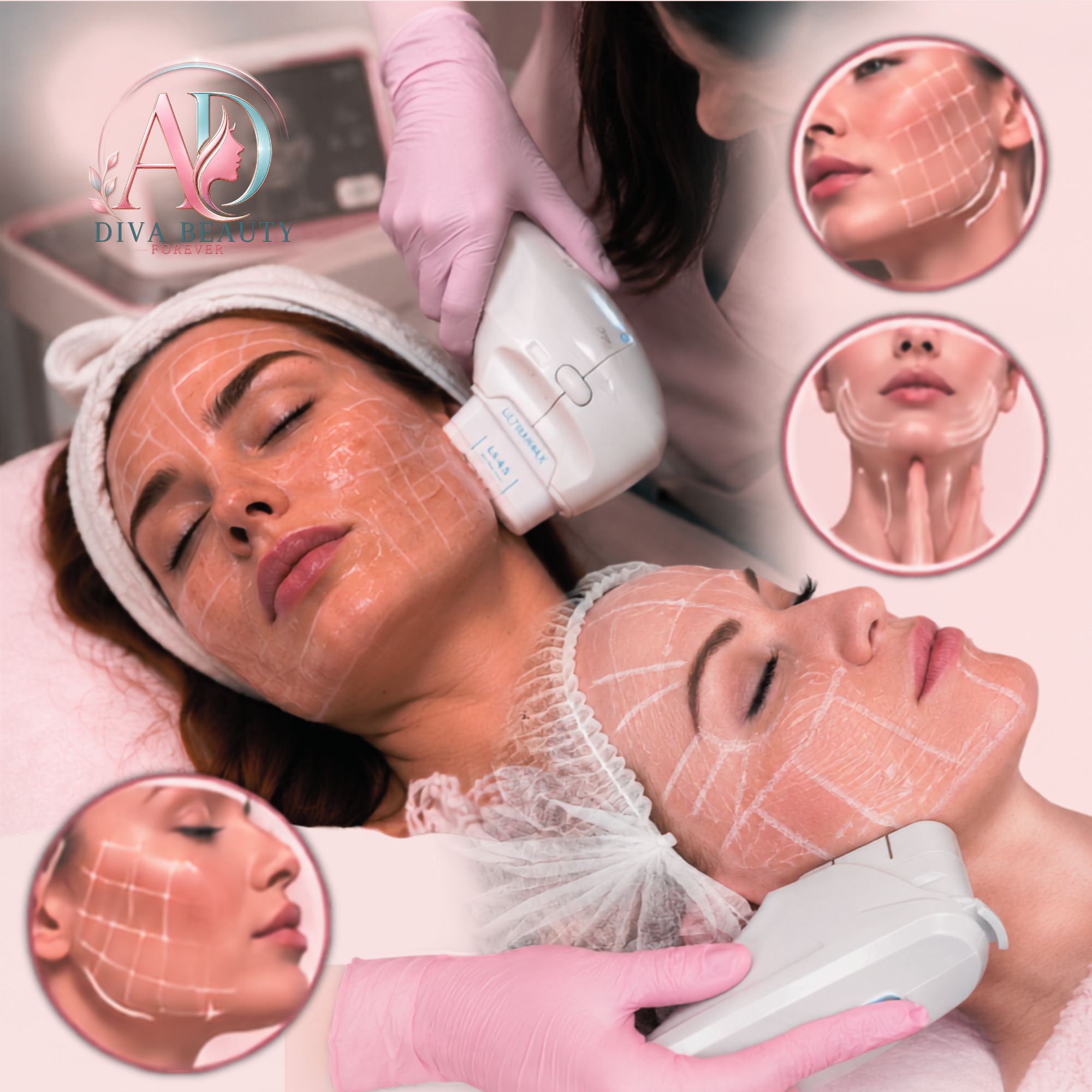 Tratament HIFU facial și corporal în Deva pentru lifting fără operație și fermitatea pielii la Diva Beauty Forever.